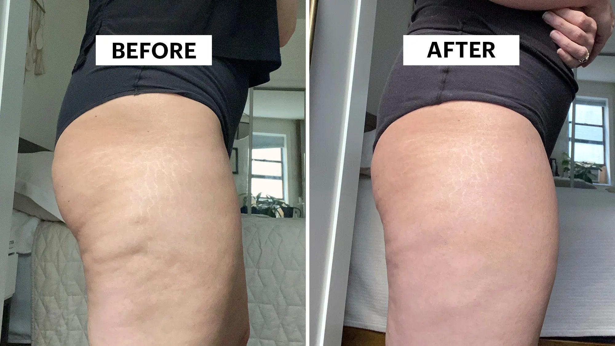 Anti-Cellulite Oil